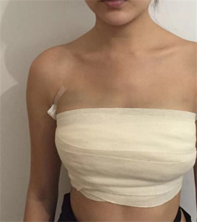 寧波珈禾整形專科醫(yī)院做隆胸手術(shù)前的胸部狀態(tài)