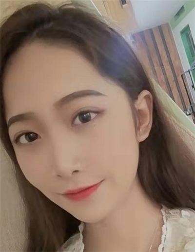 蘇州美貝爾美容醫(yī)院做面部吸脂手術(shù)后日常恢復(fù)效果