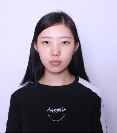 做雙眼皮案例，第四軍醫(yī)大學(xué)唐都醫(yī)院李望舟雙眼皮案例圖片