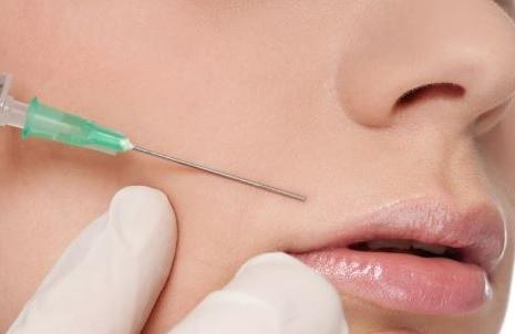 注射填充法令紋的方式有哪些？如何通過(guò)醫(yī)美手段祛法令紋？