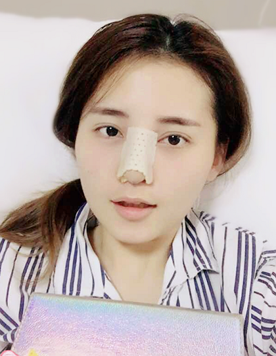 深圳微姿醫(yī)療美容門診部做鼻綜合剛剛結(jié)束手術(shù)