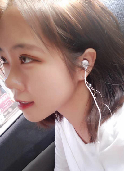 北京東方瑞麗醫(yī)療美容門診部做雙眼皮手術后恢復情況