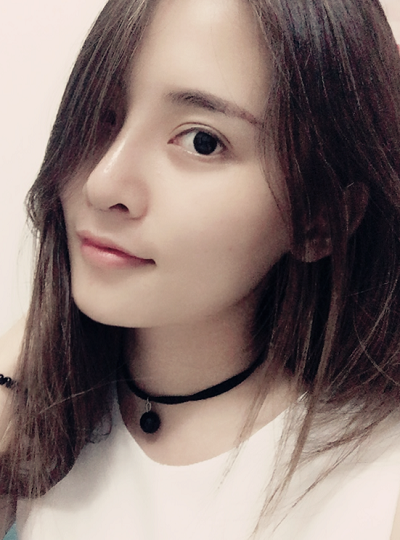 深圳微姿醫(yī)療美容門診部做鼻綜合手術(shù)后的最終效果