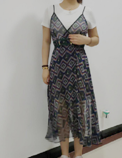 廈門海峽整形美容醫(yī)院做腰腹吸脂拆完線后