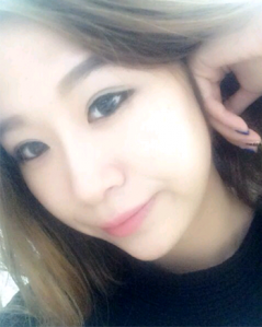 上海時光整形外科醫(yī)院做耳軟骨隆鼻術后最終狀態(tài)