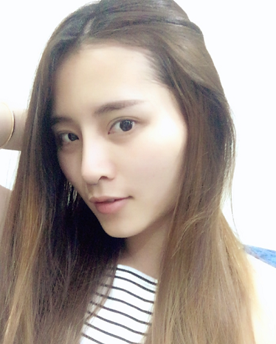 深圳微姿醫(yī)療美容門診部做鼻綜合手術(shù)后的日?；謴?fù)