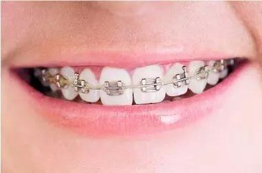 常州瀚景口腔牙齒拋光怎么樣？牙齒拋光有什么作用？