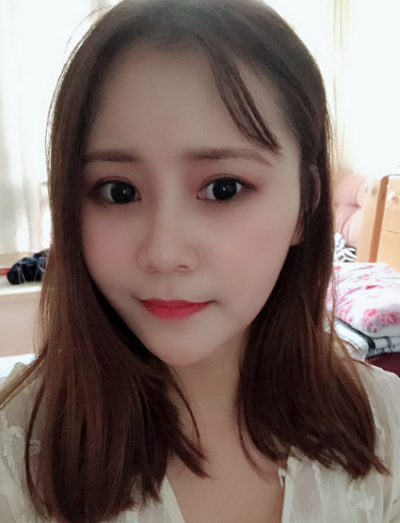 上海美萊醫(yī)療美容門診部做面部填充術后的最終效果