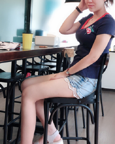 廈門海峽整形美容醫(yī)院做腰腹吸脂手術(shù)后的日常