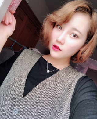 上海時光整形外科醫(yī)院做鼻綜合手術(shù)后的第一個月