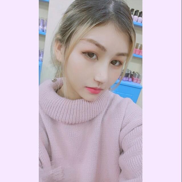 成都蜀尚蓉雅美容整形醫(yī)院做鼻綜合術(shù)后15天的情形 成都蜀尚蓉雅美容整形醫(yī)院做鼻綜合術(shù)后15天的情形