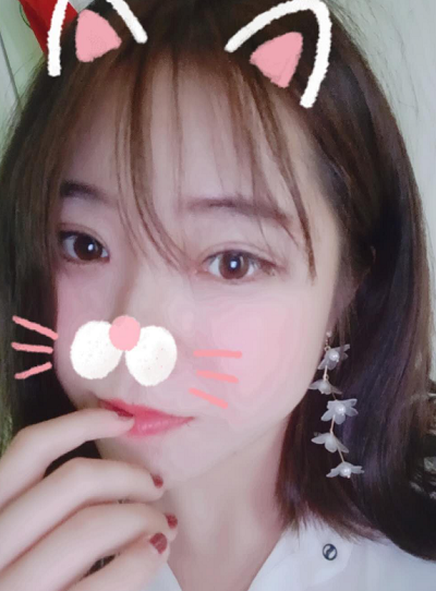 北京東方瑞麗醫(yī)療美容門診部做雙眼皮手術后的最終效果