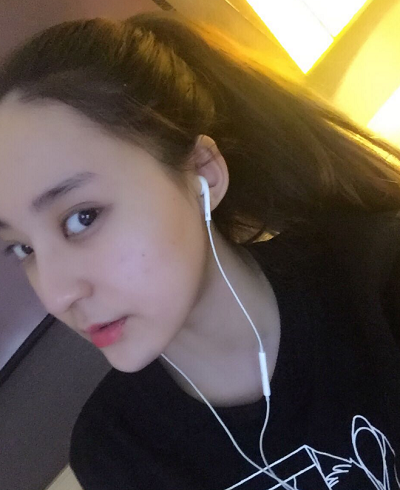 北京京民醫(yī)院（原釣魚臺醫(yī)院）整形外科做下頜骨手術(shù)后的最終效果